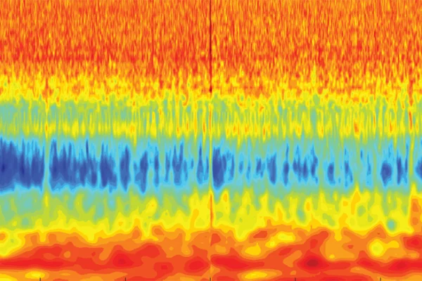 Abstract local field potential